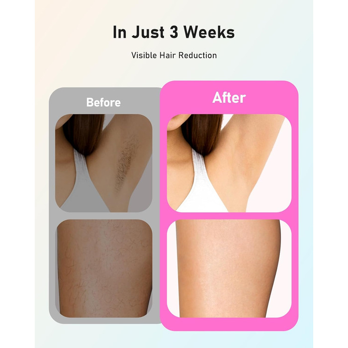 Пристрій для епіляції IPL Haarlosy - безболісна епіляція лазером, для дому, 9 рівнів, захист шкіри, для жінок та чоловіків, для обличчя, бікіні, тіла, білий (рожевий)