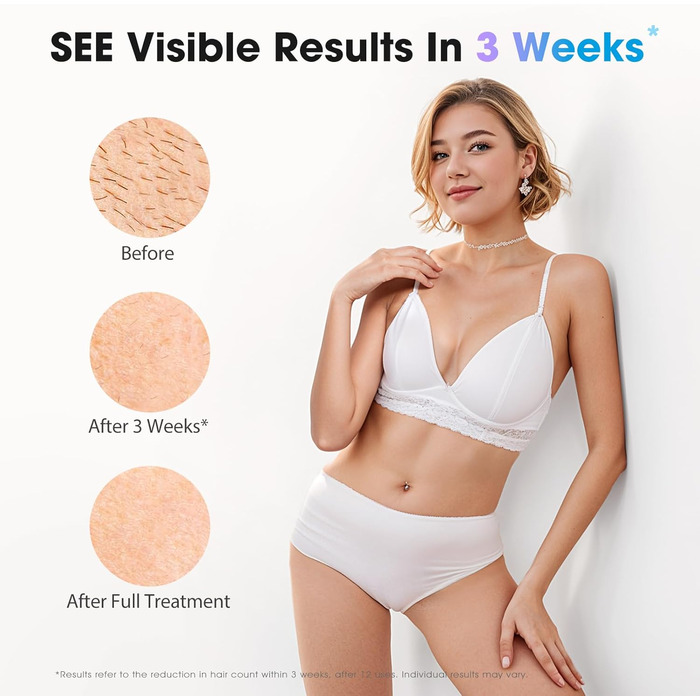 Пристрій для епіляції IPL з охолодженням, 5 рівнів потужності, 999,900 імпульсів світла, для жінок та чоловіків, обличчя, під пахвами, ноги, тіло (білий, золотий)