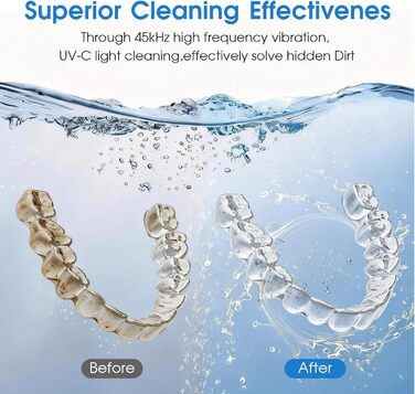 Ультразвуковий очищувач 45000 Гц з УФ-дезінфекцією 220 мл для зубних протезів, брекетів, ювелірних виробів - білий