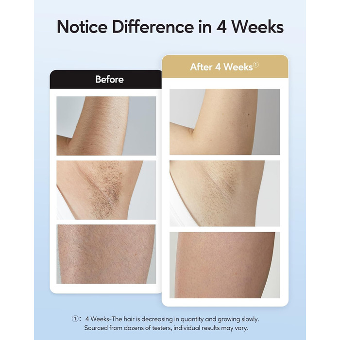 Прилад для епіляції IPL з охолодженням, 999 999 імпульсів, безболісна епіляція, 9 рівнів інтенсивності, для обличчя, бікіні, тіла, білий