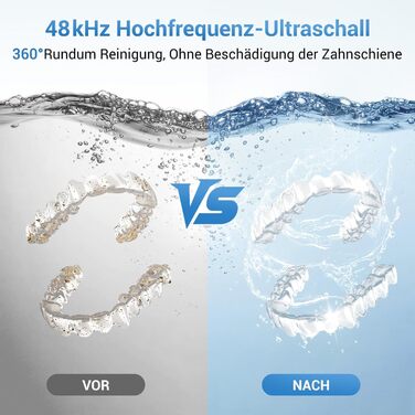 Ультразвуковий очищувач 48000Hz з УФ-дезінфекцією для зубних кап, брекетів, протезів та ювелірних виробів - 300 мл, 24 Вт