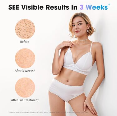 Пристрій для епіляції IPL Haarlosy з охолодженням, 5 рівнів потужності, 999 900 імпульсів, для жінок та чоловіків, обличчя, під пазухами, ноги, тіло (білий, рожеве золото)