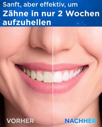 Електрична зубна щітка зі звуковими вібраціями, 8 насадок (3 типи), таймер, 120 днів роботи від акумулятора, 5 режимів чищення, чорний колір, для дорослих, з зарядною станцією
